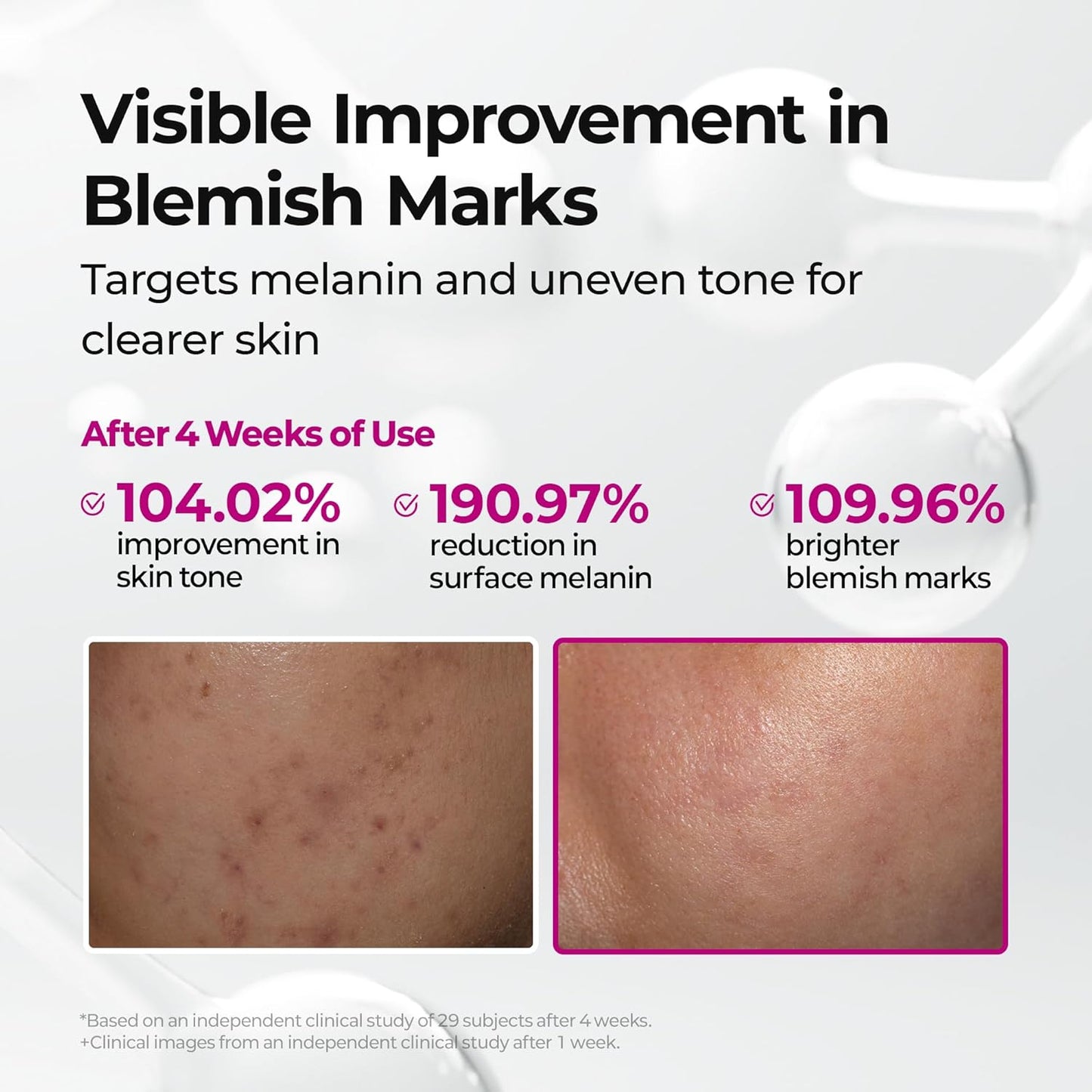 Cemenrete Picotonic Shot Calcium Ampoule – Brightening & Firming Serum with Calcium, Collagen & Niacinamide for Dark Spots, Uneven Skin Tone & Skin Clarity, Korean Skincare, 1.01 Fl.Oz