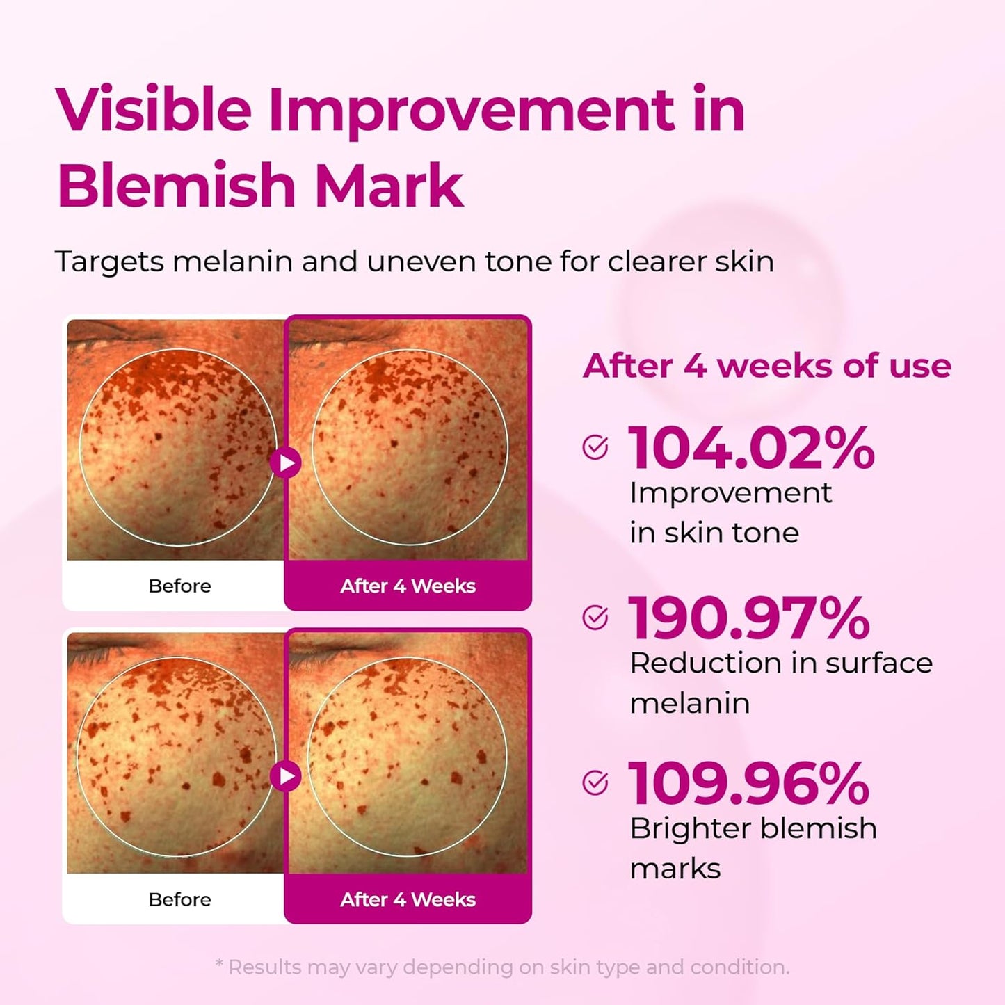 Cemenrete Picotonic Shot Calcium Ampoule – Brightening & Firming Serum with Calcium, Collagen & Niacinamide for Dark Spots, Uneven Skin Tone & Skin Clarity, Korean Skincare, 1.01 Fl.Oz