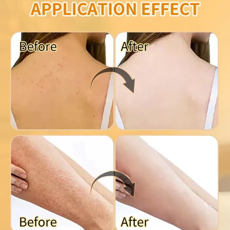 VC & Turmeric Exfoliating Body Scrub Whitening Brightening Remove Dead Skin Nourish Smooth Body Cleanser Skin Care