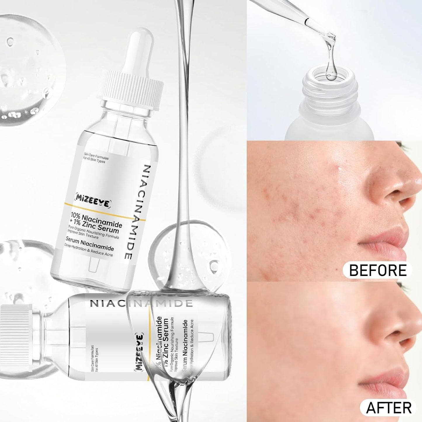 Niacinamide 10% + Zinc 1% Serum for Face, 30ML/1 Fl Oz Moisture Niacinamide Face Serum for Women, Refreshing.