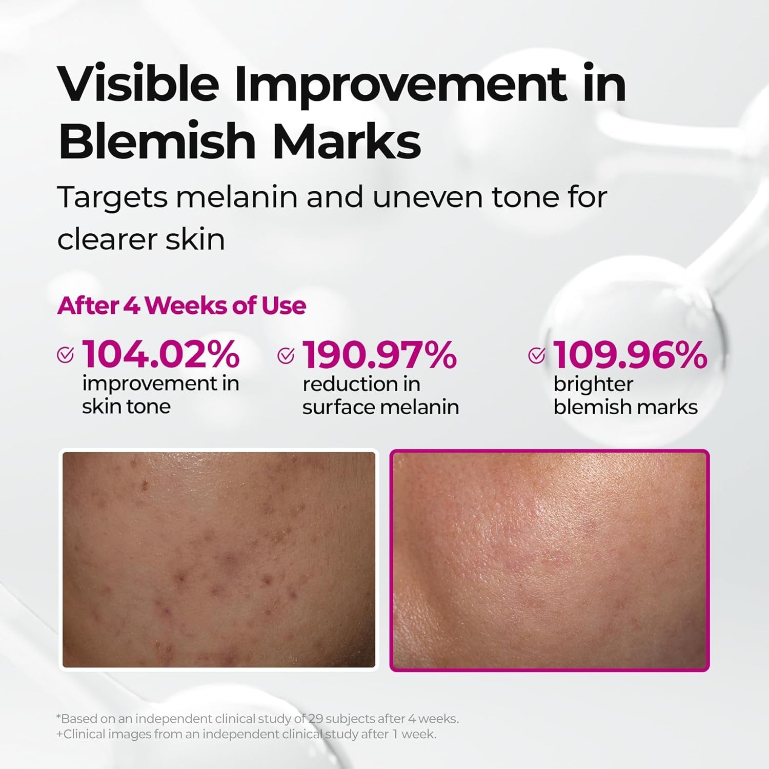 Cemenrete Picotonic Shot Calcium Ampoule – Brightening & Firming Serum with Calcium, Collagen & Niacinamide for Dark Spots, Uneven Skin Tone & Skin Clarity, Korean Skincare, 1.01 Fl.Oz