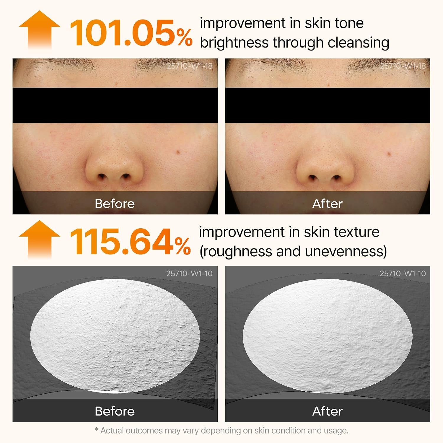 Kojic Acid Dark Spot Corrector Peeling Ampoule – AHA BHA Exfoliating Serum with Kojic Acid & Niacinamide for Dark Spots & Uneven Skin Tone, Korean Skincare 2.71 Fl.Oz